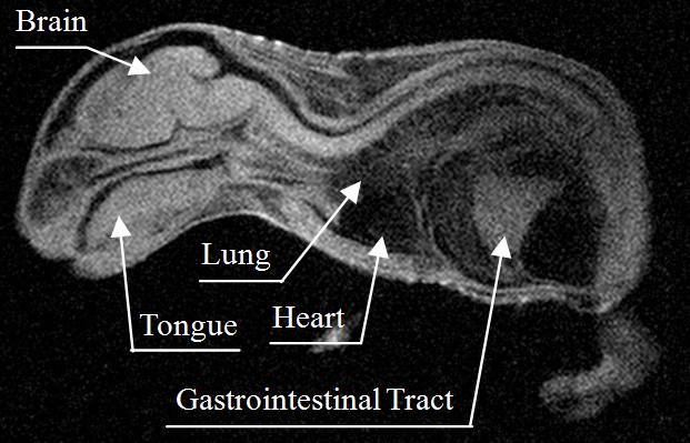 Mouse fetus image (about 25mm long)